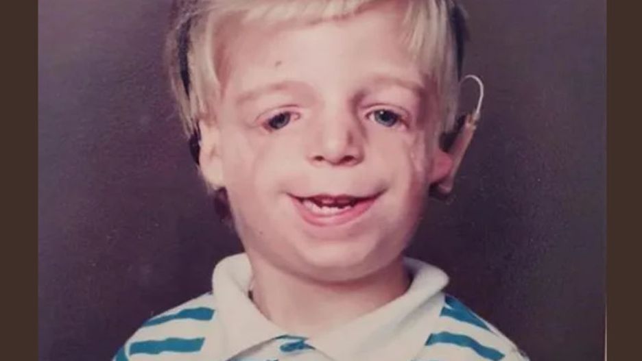 Tuż po narodzinach porzucili go w szpitalu. Tak chłopiec wygląda dzisiaj