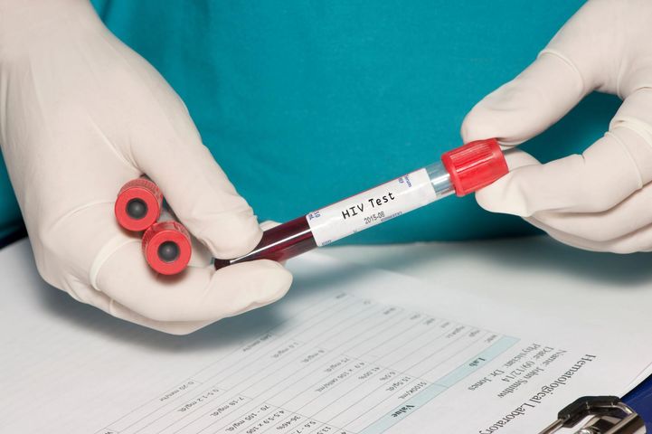 Testom na HIV powinny poddać się osoby podejmujące ryzykowne zachowania.
