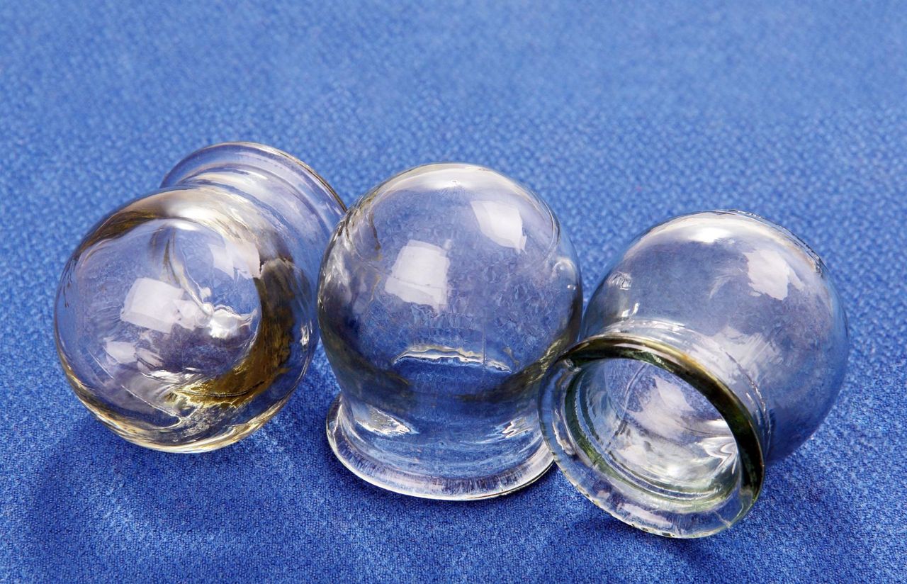 Czy warto stawiać dziecku bańki?