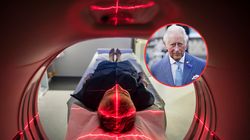 Król walczy z rakiem. "Prawdziwa plaga", która zwiększa ryzyko diagnozy