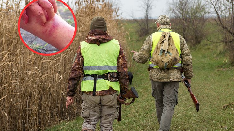 Zagłębie KZM i boreliozy. Tu jest najwięcej przypadków