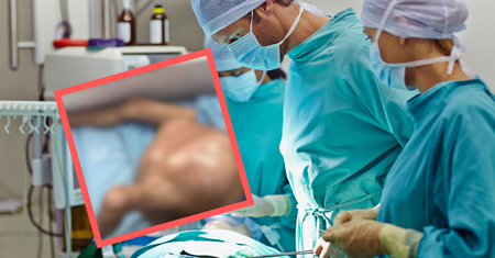 Wyjątkowa operacja chirurgów z Indii. Usunęli guza o wadze dziecka