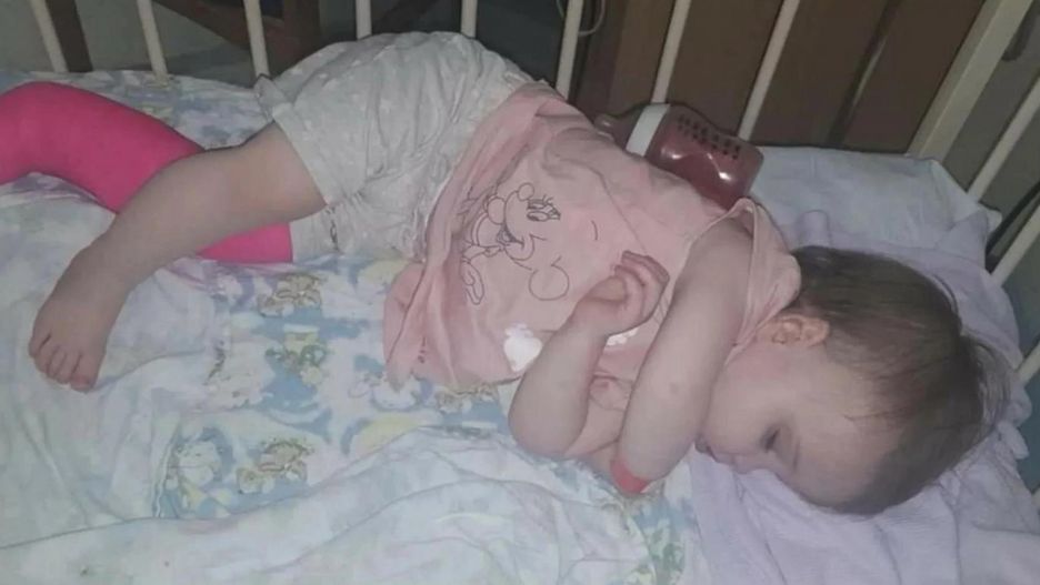 Okazało się, że dziewczynka cierpi na rzadką chorobę