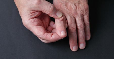 Bywa mylona z reumatyzmem. Drętwienie dłoni jest pierwszym objawem
