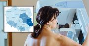 MZ publikuje wolne terminy na cytologię i mammografię. Lubuskie nie ma żadnego