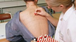 Koronawirus w Polsce. Czy można brać leki na alergię przed szczepieniem? Prof. Szuster-Ciesielska odpowiada