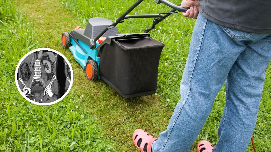 Mógł stracić życie przez śmiertelnie groźną bakterię