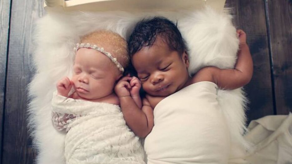 Kachi urodziła się jako albinoska