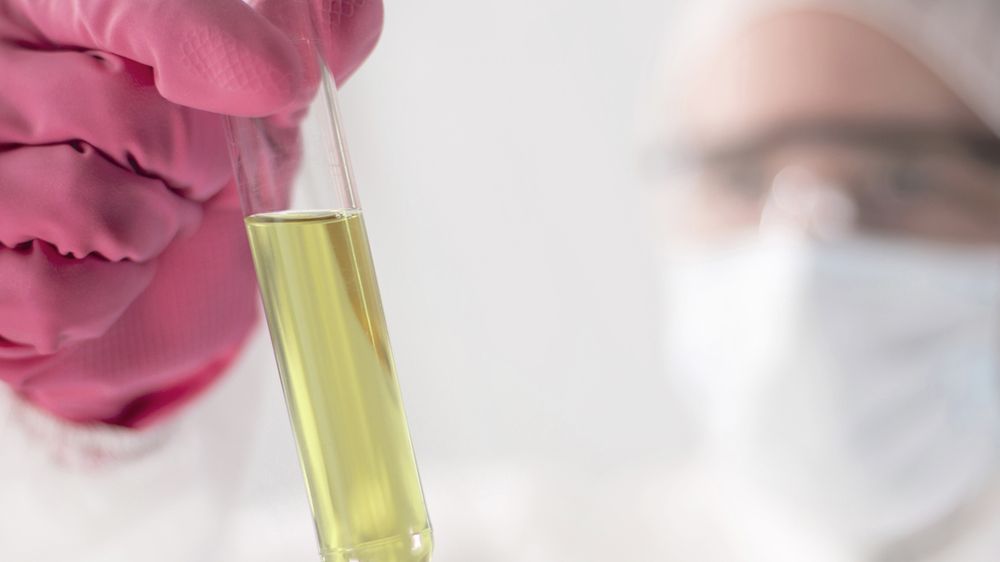 Ciała ketonowe w moczu