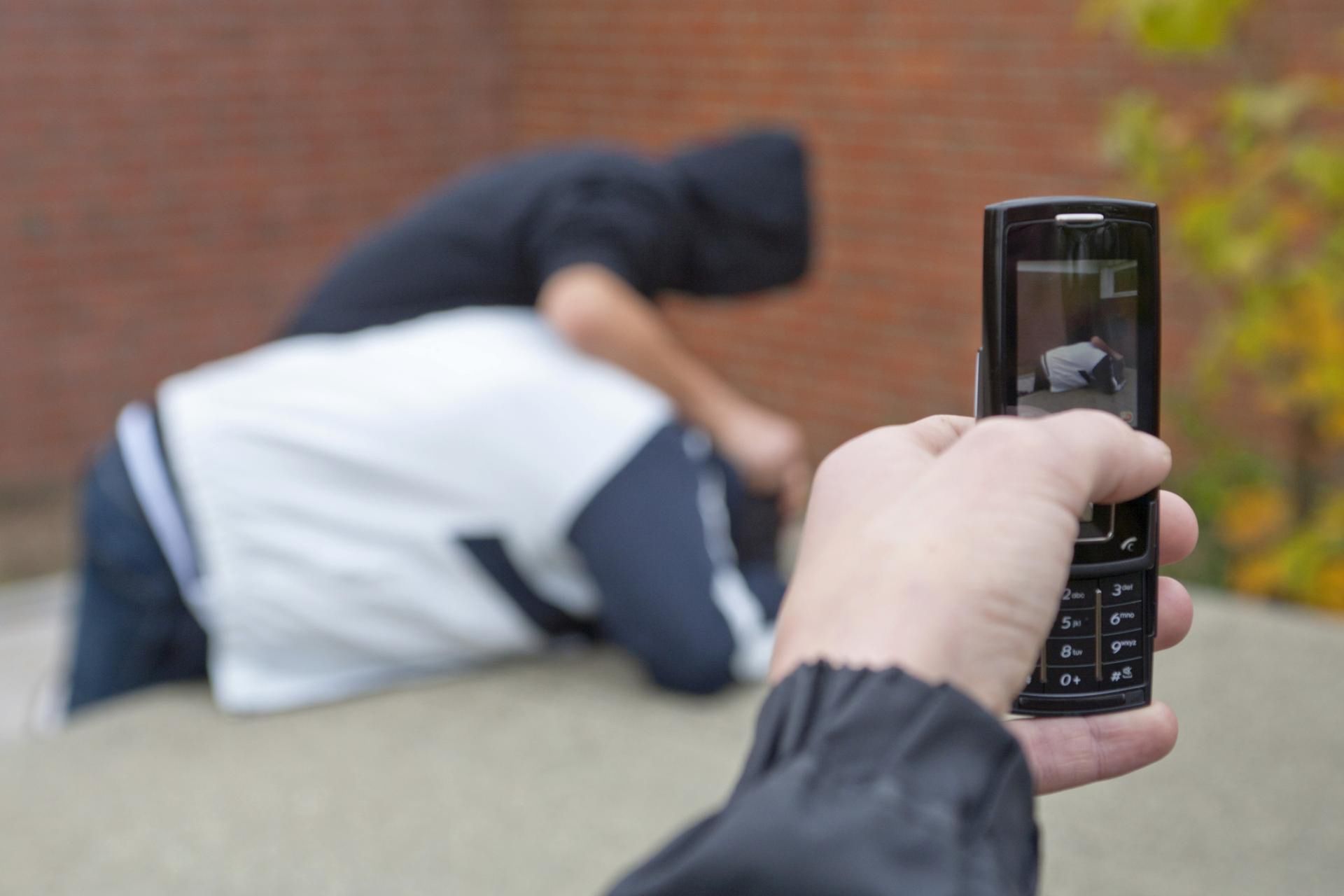 12-latek odgryzł koledze kawałek skóry z czoła
