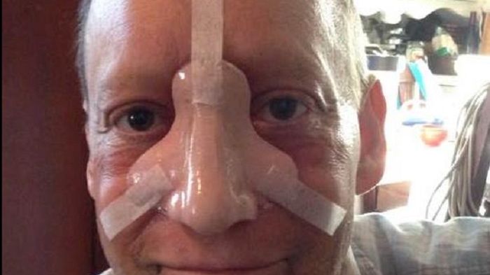 Steve Bean zmarł z powodu raka nosa