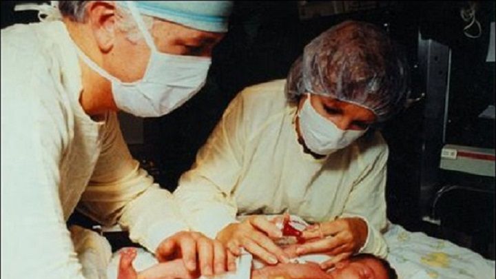 Baby Fae miała przeszczep serca