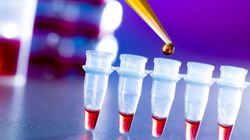 Jestem zdrowa i młoda. Sprzedam swoje komórki rozrodcze