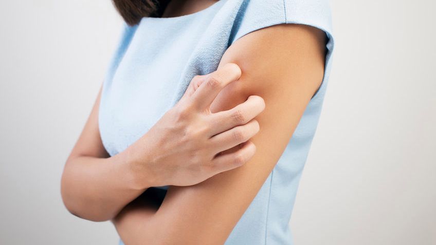 Łupież pstry może objawiać się swędzeniem skóry