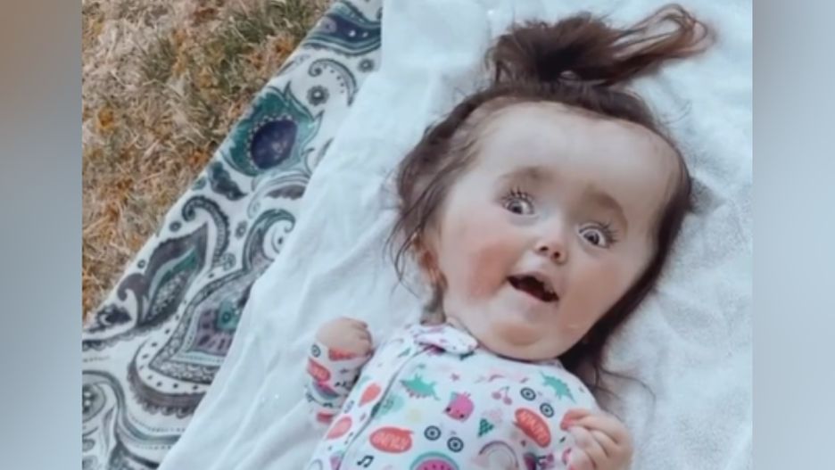 Luna przyszła na świat przedwcześnie, a wkrótce po jej narodzinach zdiagnozowano u niej rzadką chorobę