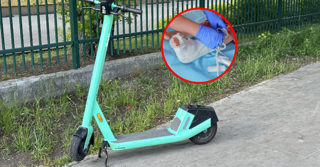 Plaga urazów przez hulajnogi. "Nie ma tygodnia bez hospitalizacji"