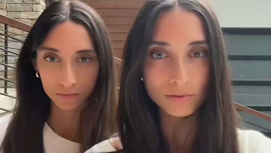 Są bliźniaczkami momo. Taki przypadek zdarza się raz na 35 tysięcy