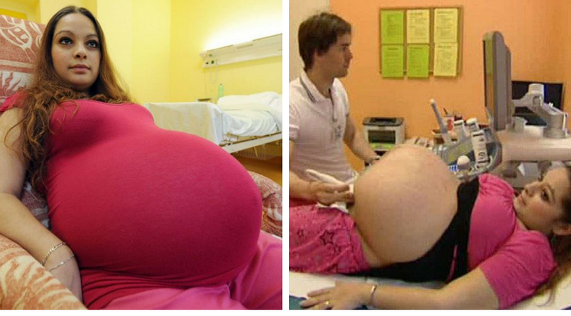 Kobieta w ciąży miała ogromny brzuch 