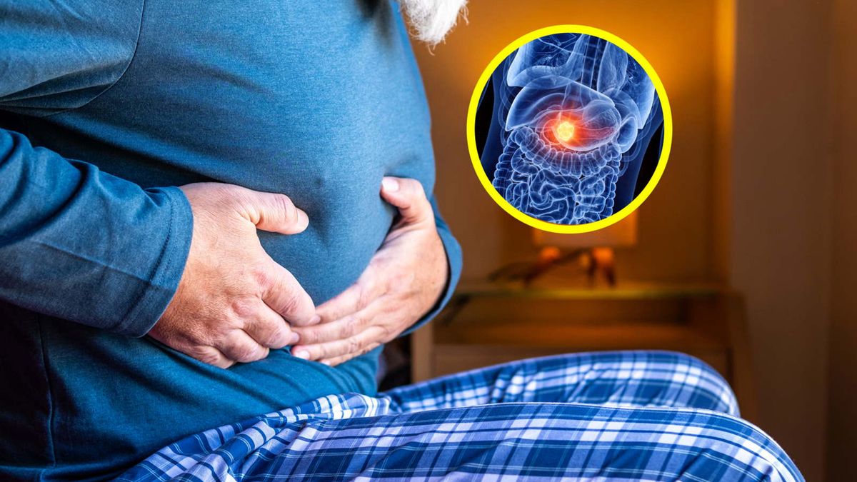 Naukowcy wskazali czynnik, który zwiększa ryzyko raka trzustki