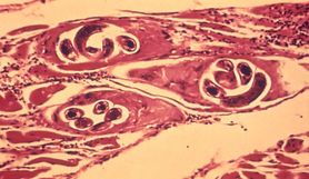 Włosień kręty – cykl rozwojowy, zakażenie i objawy włośnicy