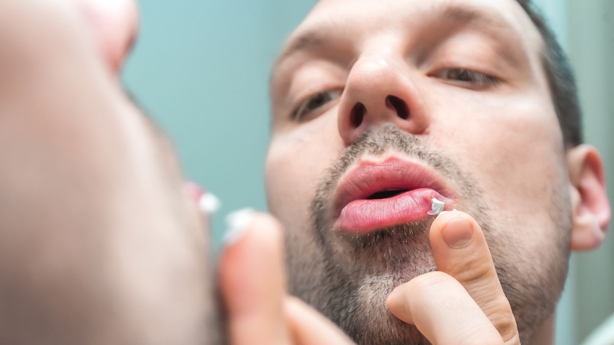 Kosmetyki na opryszczkę są dostępne w postaci kremów i maści