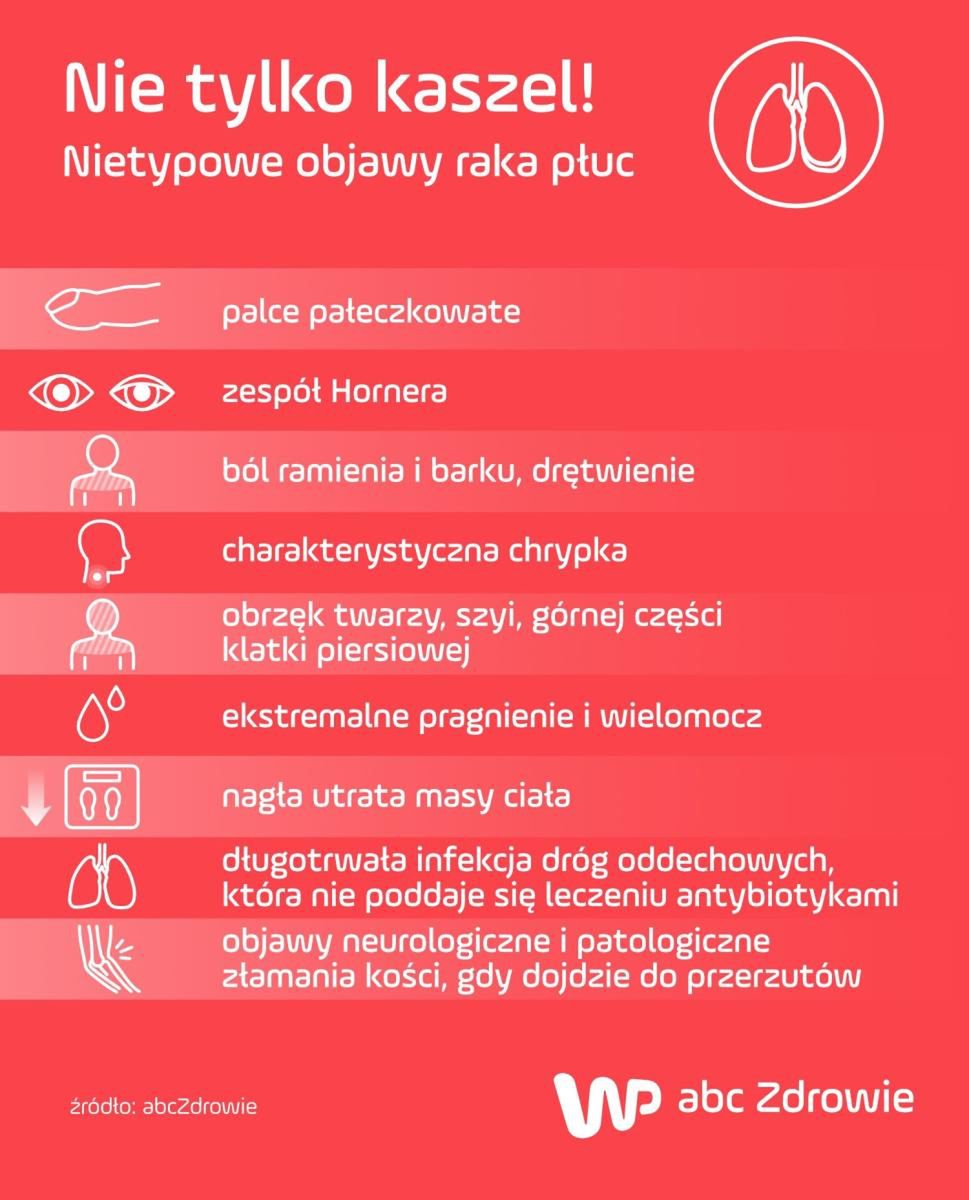 Podstępny nowotwór, który może dawać nietypowe objawy