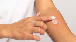 Kwas fusydowy - właściwości, działanie, wskazania i przeciwwskazania