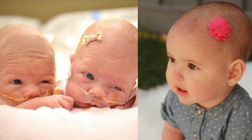 Klej służy do przyklejania ozdób na głowę 