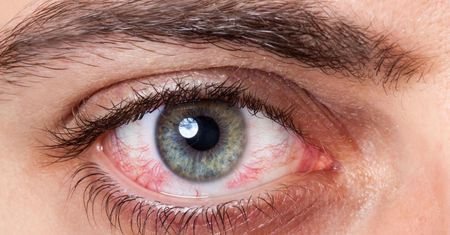 Zapalenie spojówek a alergia – jak rozróżnić? Porady eksperta