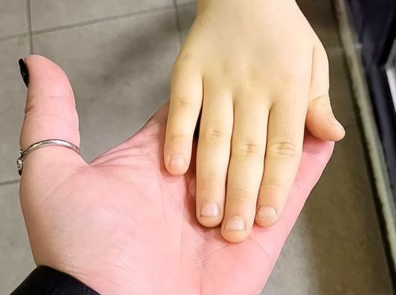 6-latek zrobił się żółty. Podejrzewali wątrobę, winien okazał się popularny owoc