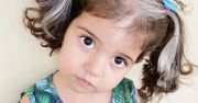 Dziewczynka siwieje od urodzenia. Uczy się akceptować swoją wyjątkowość