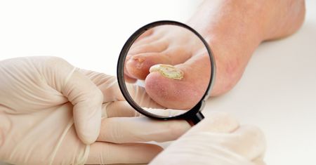 8 powodów, które mogą być przyczyną odbarwienia paznokci