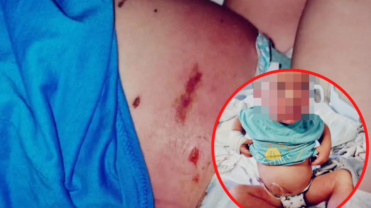 Mama opublikowała zdjęcia synka ku przestrodze