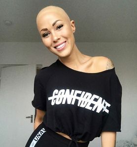 Myślała, że jest chora na raka. Włosy wypadały z innego powodu