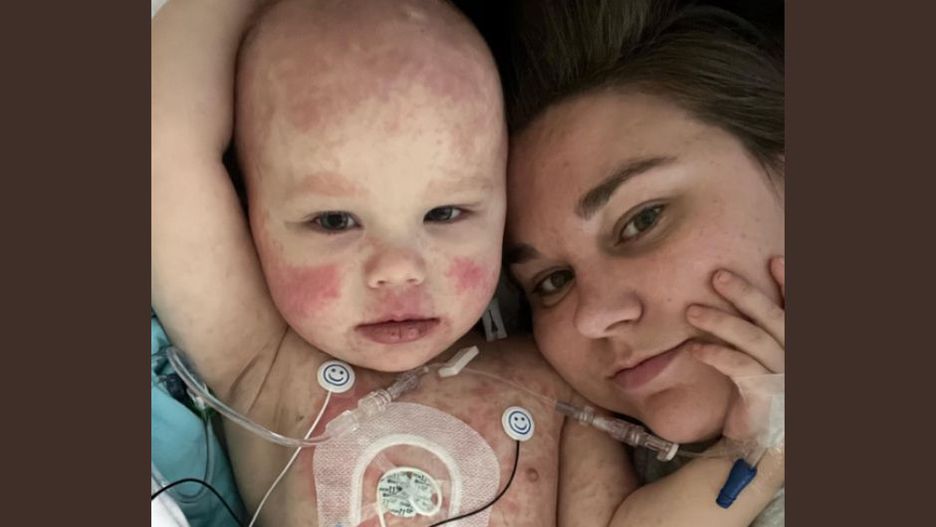 Myśleli, że ząbkuje. U niemowlęcia wykryto groźną chorobę