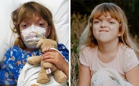 9-letnia Ania Nowak cierpi na zespół Pfeiffera. Jej mózg rośnie, ale czaszka nie