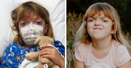 9-letnia Ania Nowak cierpi na zespół Pfeiffera. Jej mózg rośnie, ale czaszka nie