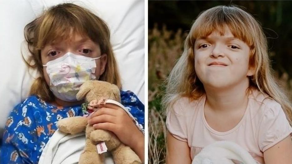 Ania prosi o pomoc Cierpi na rzadką chorobę genetyczną 