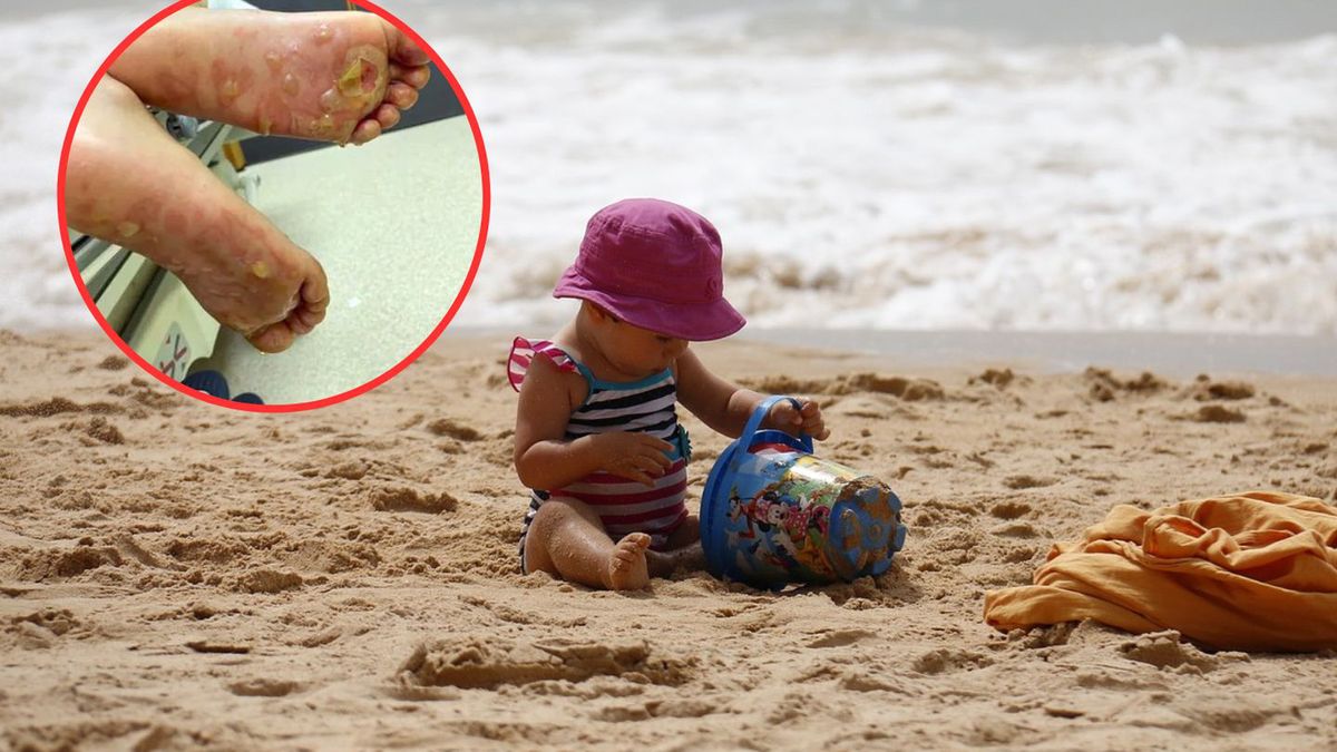 2-latka biegła po plaży. "Zaczęła przeraźliwie krzyczeć"