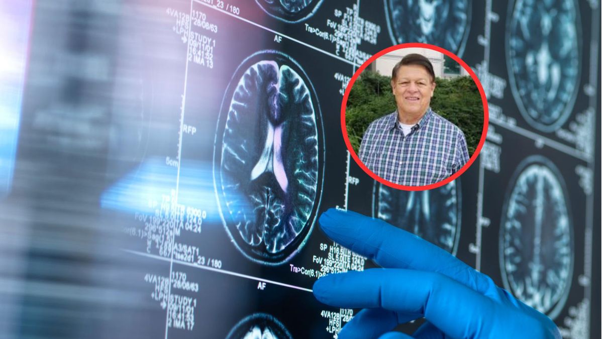 Zespół z USA odkrył kombinację naturalnych składników, które wspierają komórki mózgu