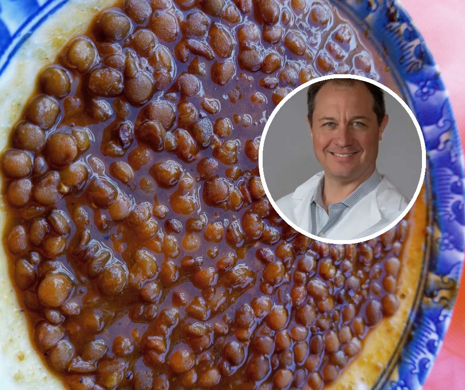 Mówi, że "działają jak Ozempic". Lekarz wymienia 4 cenne produkty