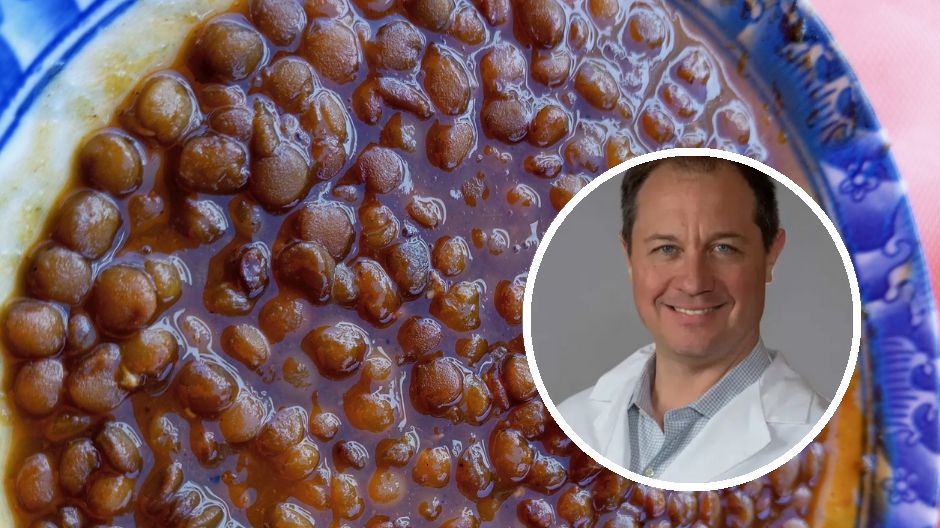 Cztery produkty, które pomagają chudnąć. Niektórzy porównują je z Ozempikiem