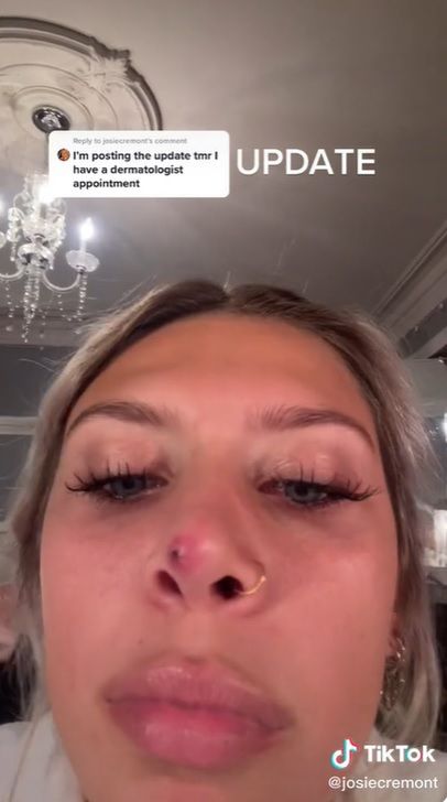 Każda operacja jest obarczona ryzykiem powikłań