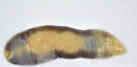 Fasciolopsis buski	- cykl rozwojowy, objawy i leczenie fasciolopsozy