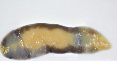 Fasciolopsis buski	- cykl rozwojowy, objawy i leczenie fasciolopsozy