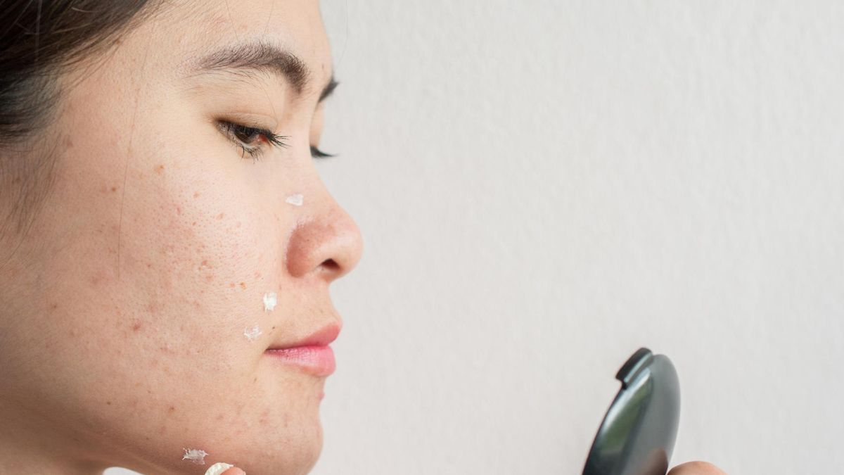 Krosty pojawiają się z wielu powodów i to właśnie od przyczyny zależy leczenie