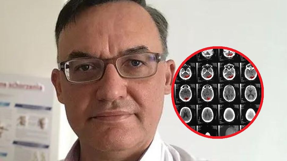 Mikroudary mogą pojawić się nawet kilka tygodni po przechorowaniu COVID-19