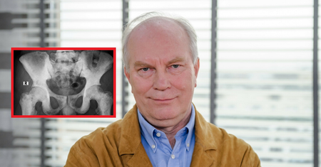 Prof. Szczylik o chorobie nowotworowej. "Bałem się, jak każdy"