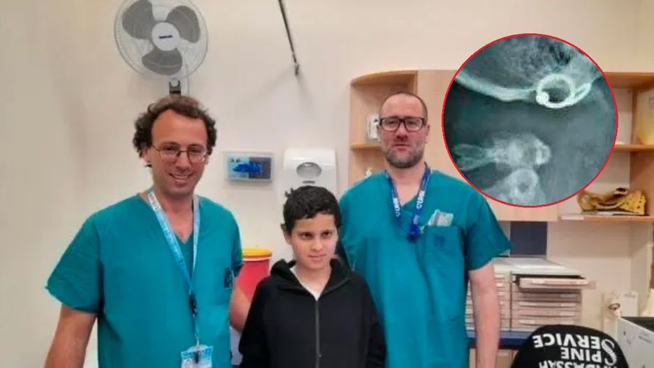 Lekarze z z 12-letnim Suleimanem Hassanem