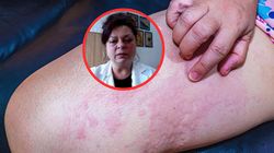 Coraz więcej chorych w Polsce. "Wirus przenosi się bardzo łatwo"